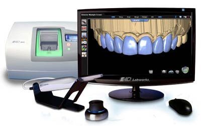Diseño prótesis dentales mediante tecnología Cad-Cam - Clínica Las ...